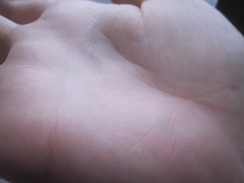 蕁麻疹が発生していない綺麗な手の平